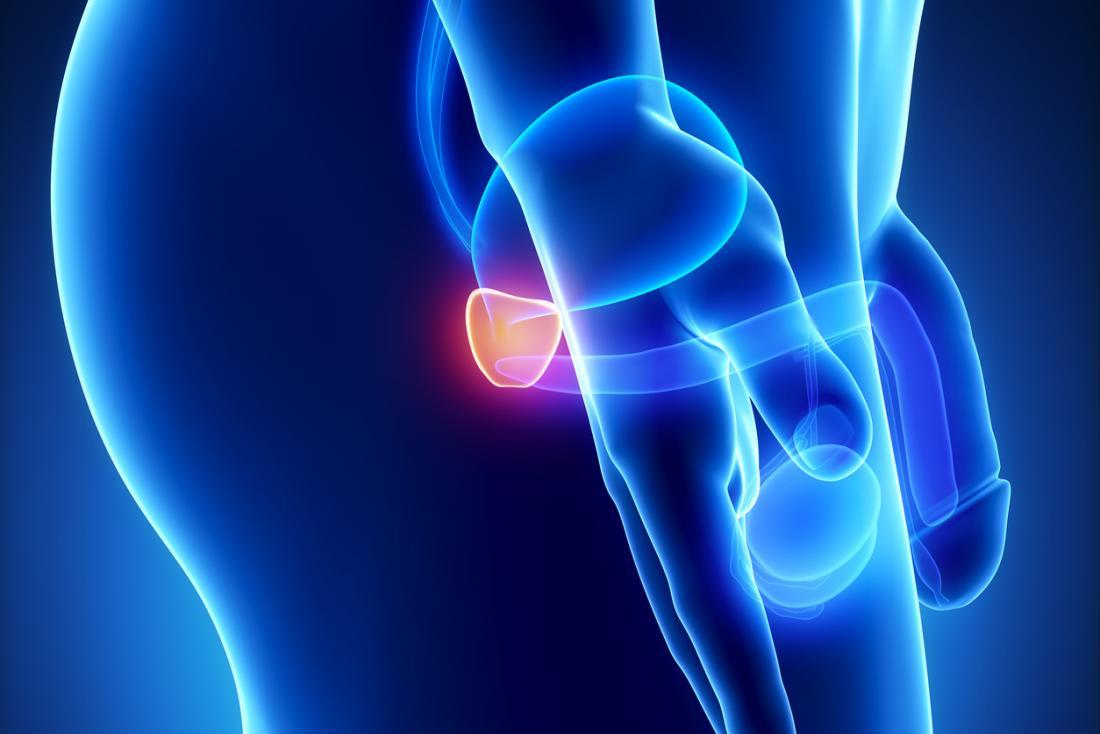 prostate supplement-PROSTATE SUPPORT Advanced Complex-1B- anti-inflammatory