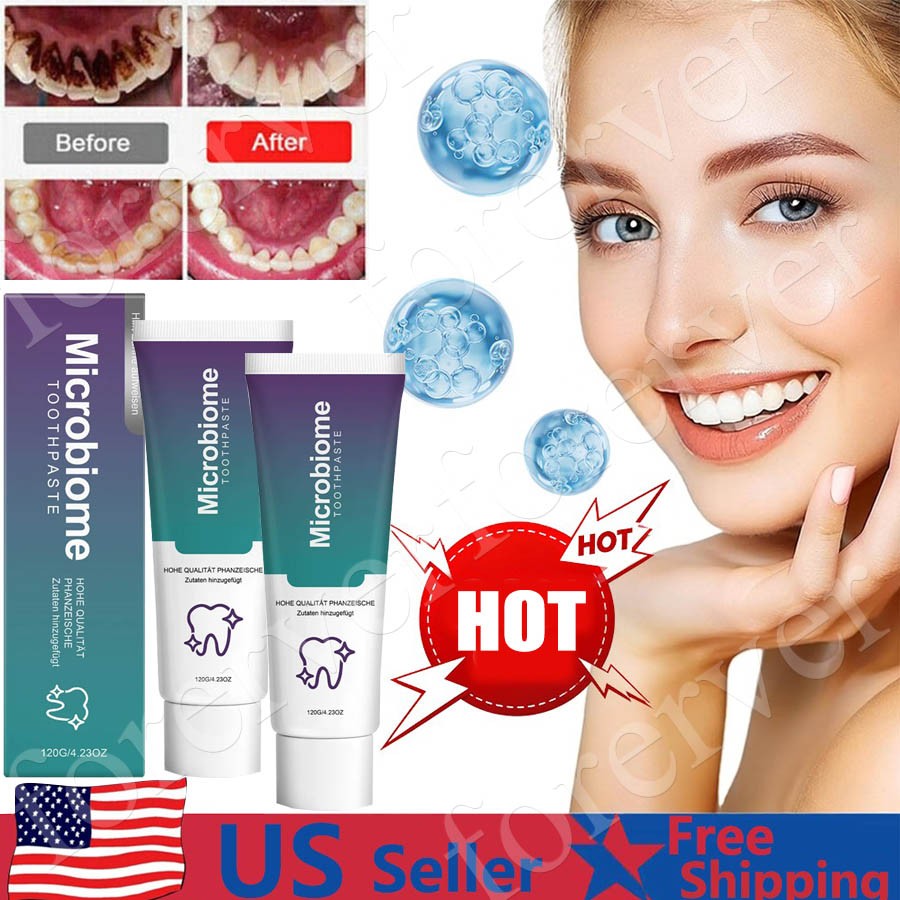 1-5PCS Microbiome Mint Flavor Gum Toothpaste Cleaning Toothpaste Sensitive Teeth