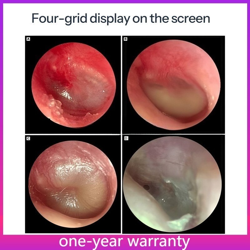 1080p HD Endoscopy/4K UHD ENT 2 in 1 Integrated Endoscope Laparos