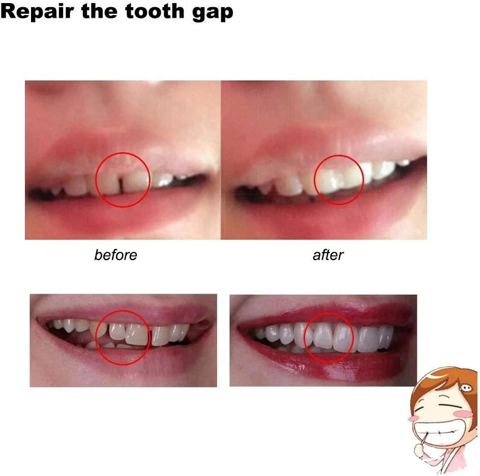 3 Colors Temporary Moldable False Teeth Repair Replacement Thermal Fitting...