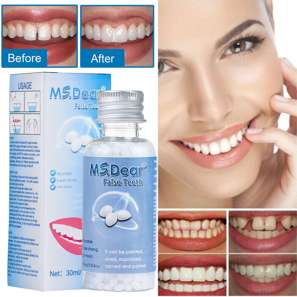 Tooth Repair Kit-Temporary Teeth Replacement Kit for Missing & Broken Teeth 30ML