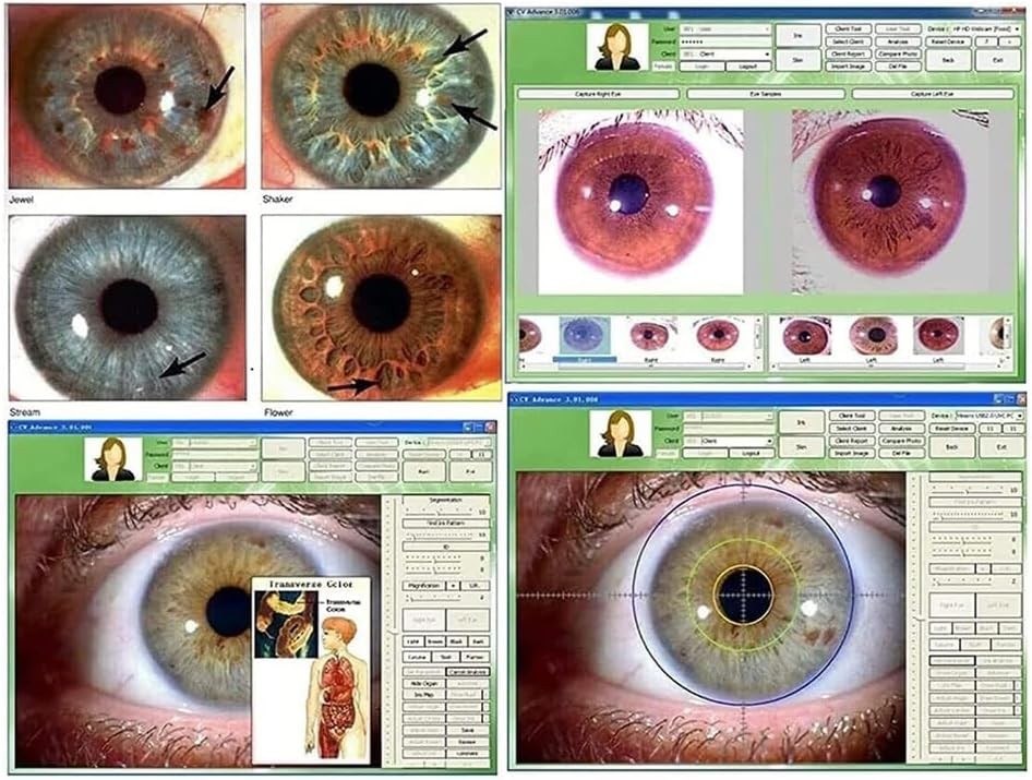 5.0MP USB Iris Analysis Camera Eyes Analyzer Iridology English/Spanish Software