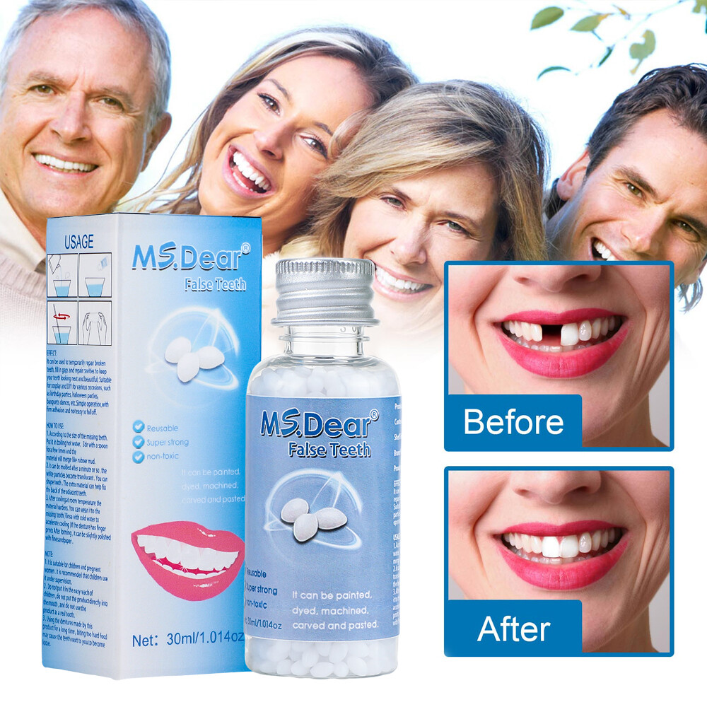2X Tooth Repair Kit - Temporary Teeth Replacement Kit for Missing & Broken Teeth