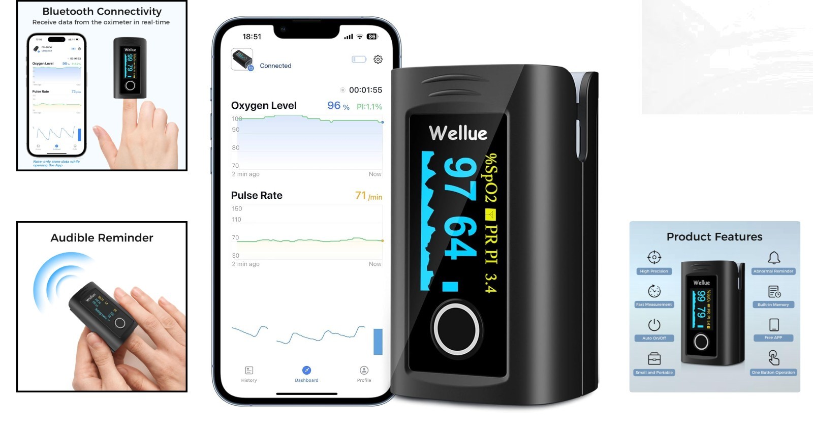 FSA Eligible Fingertip Pulse Oximeter with Free App & Built-in Memory Function