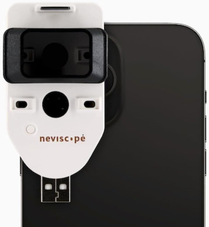 Neviscope Black Phone Dermatoscope Microscope with Polarized Lens/LED Light