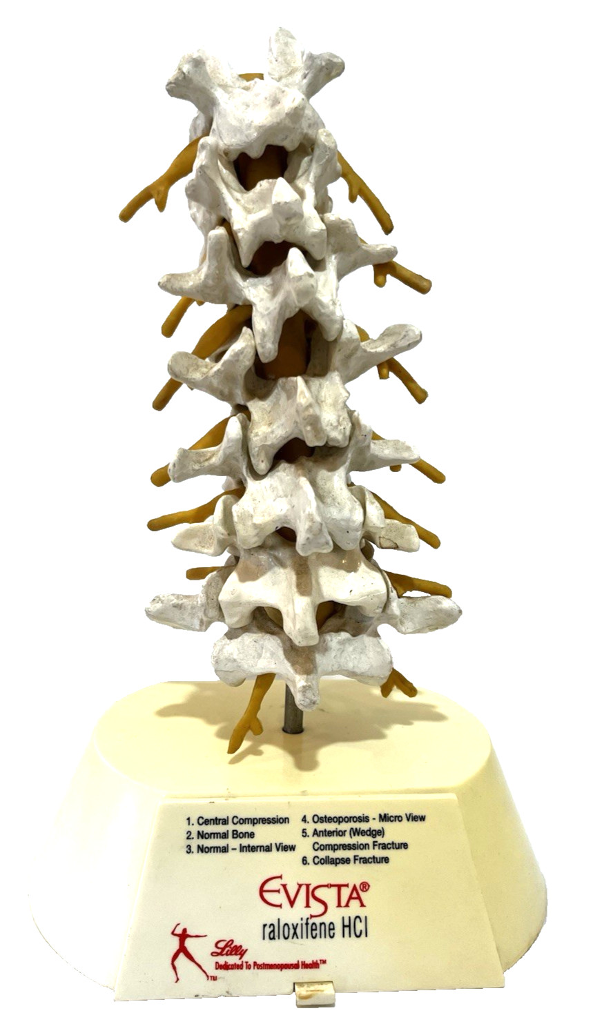 Vntg Doctors EVISTA Raloxifene HCI The Lilly Osteoporosis Spine Model Realistic