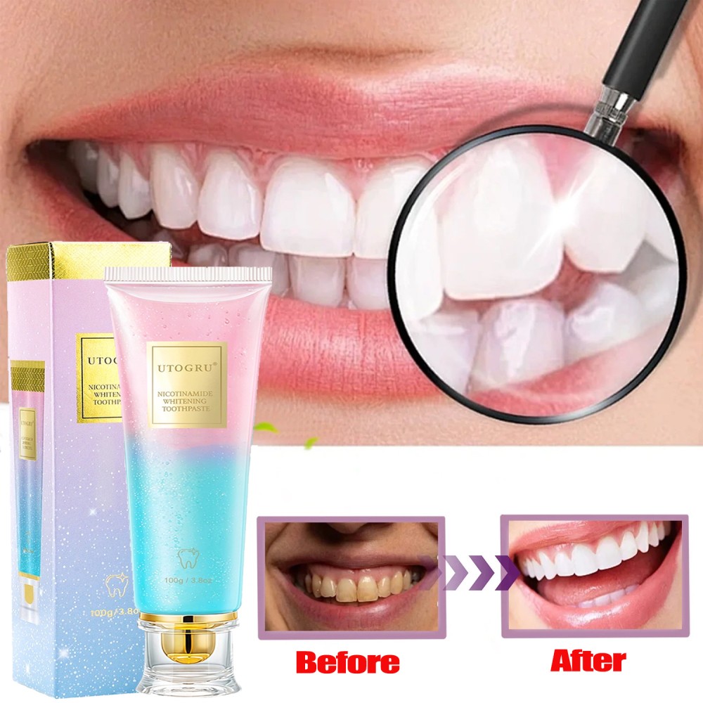 100g Niacinamide Whitening Toothpaste - Proven Stain Removal & Fresh Breath US