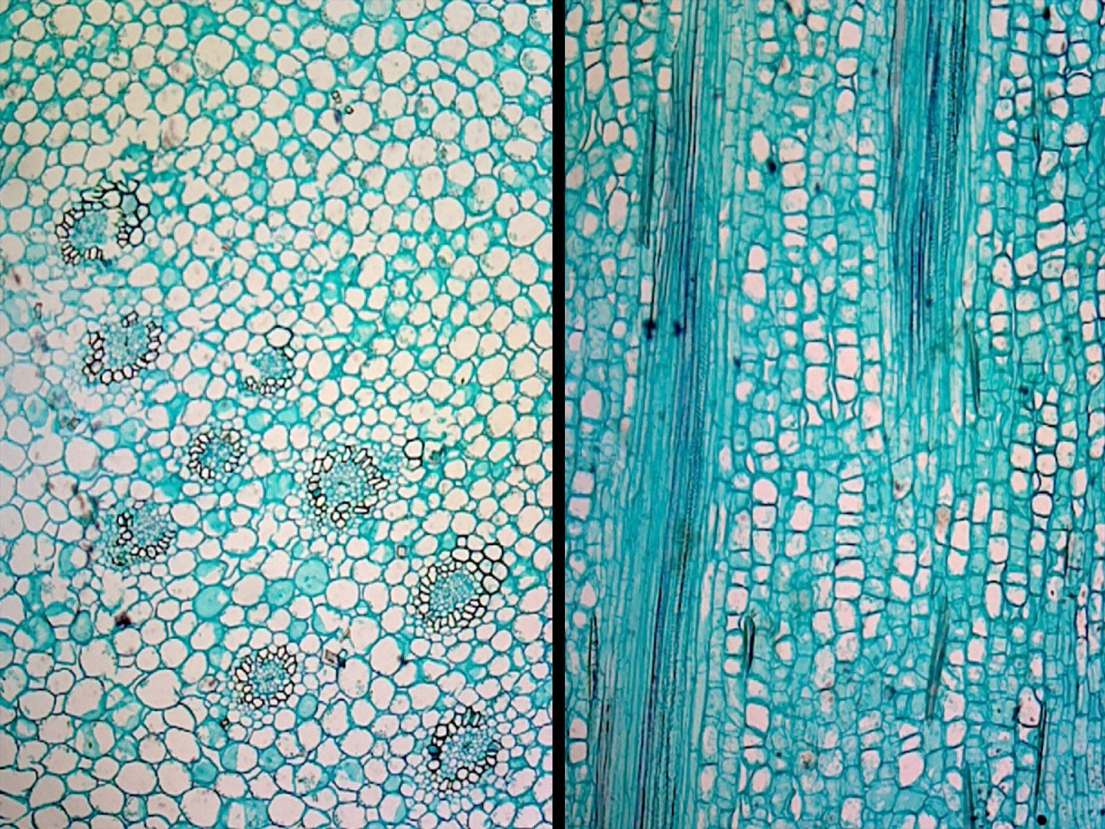 Iris Stem; Typical Monocot Stem; Cross Section and Longitudinal Section