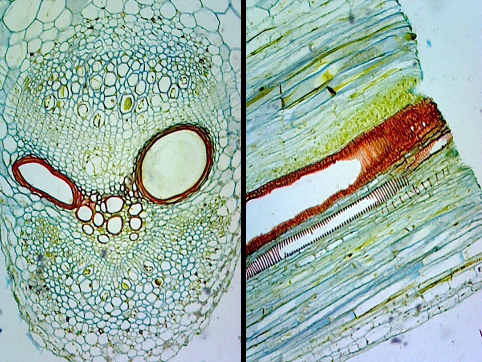 Pumpkin (Cucurbita) Stem; Typical Dicot Stem; Cross Section and Longitudinal
