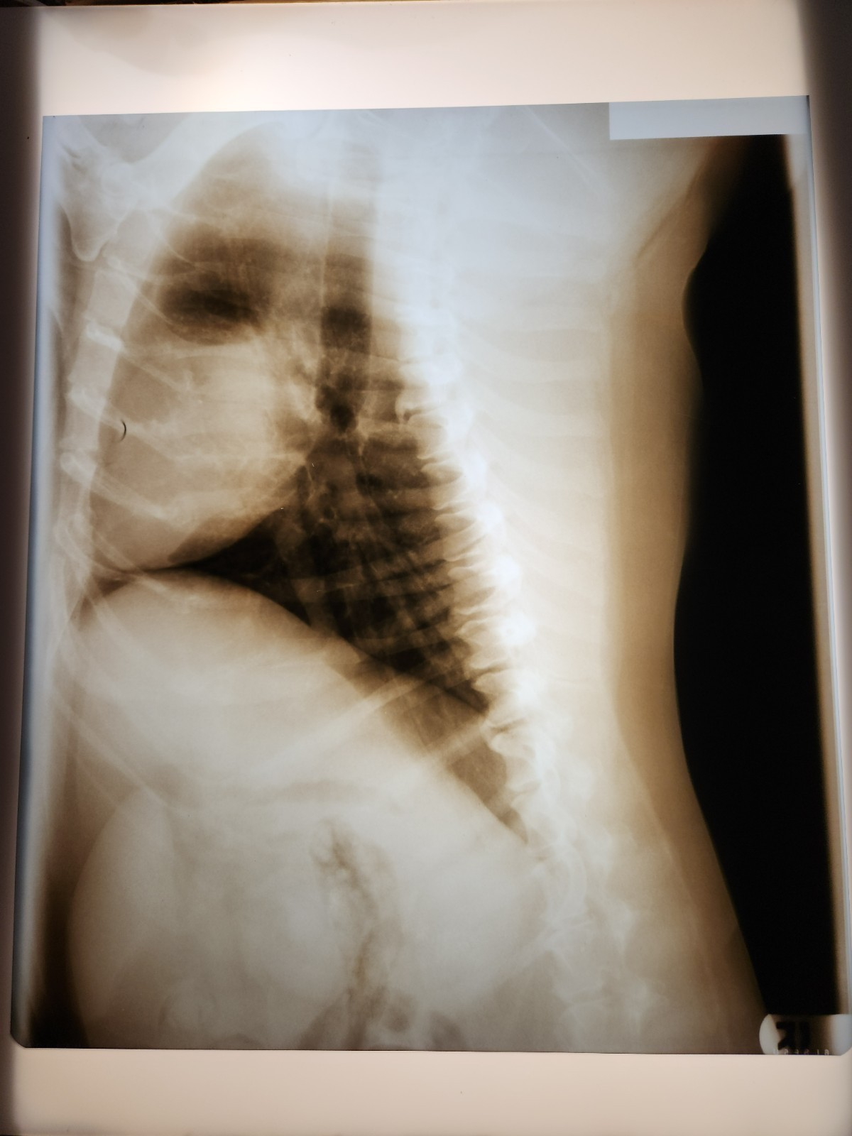 Animal X-Ray Film Negative Print – Canine Dog 16 ½” x 14" XRay Medical Bones D07