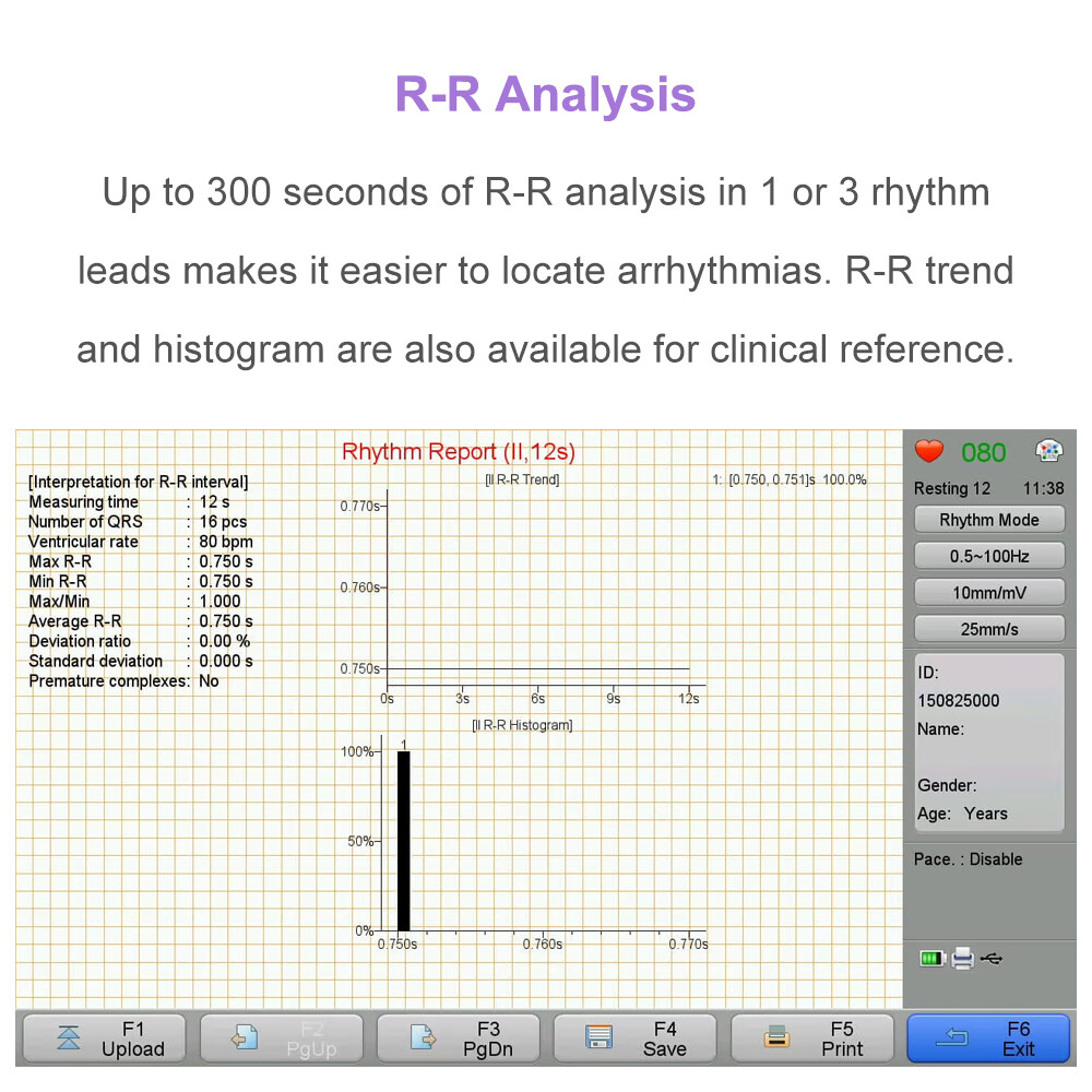 12 channel ECG Machine with interpretation for advisory diagnosis FDA approved