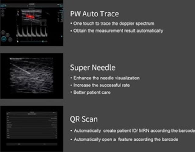 Supper Small Chison SonoEye P1 Linear Array for android Color Doppler Vascular