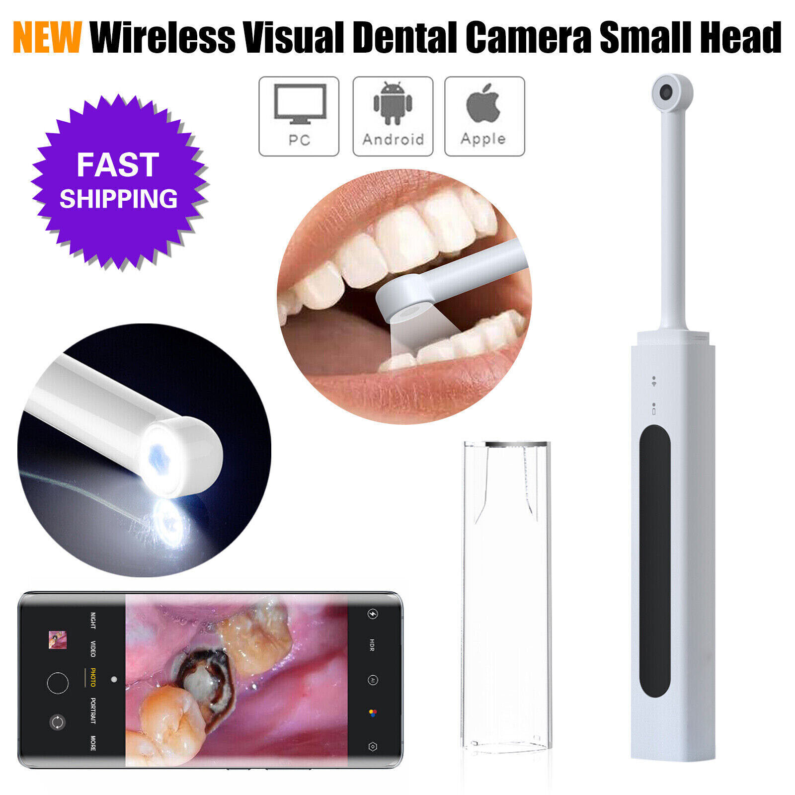 Digital Dental Intra Oral Intraoral Camera WIFI Endoscope Imaging USB System