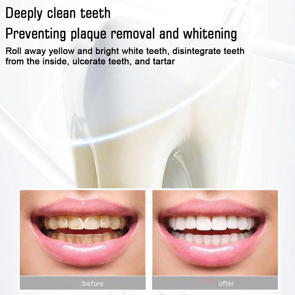 2PCS SP-6 Probiotic Toothpaste,Sp-6 Toothpaste Whitening Quick White Toothpaste
