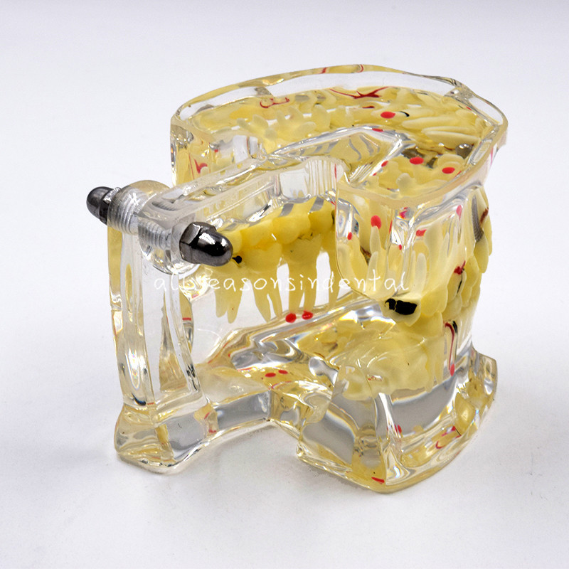Dental Transparent Study Demonstrations Teeth Model Adult Pathological Disease