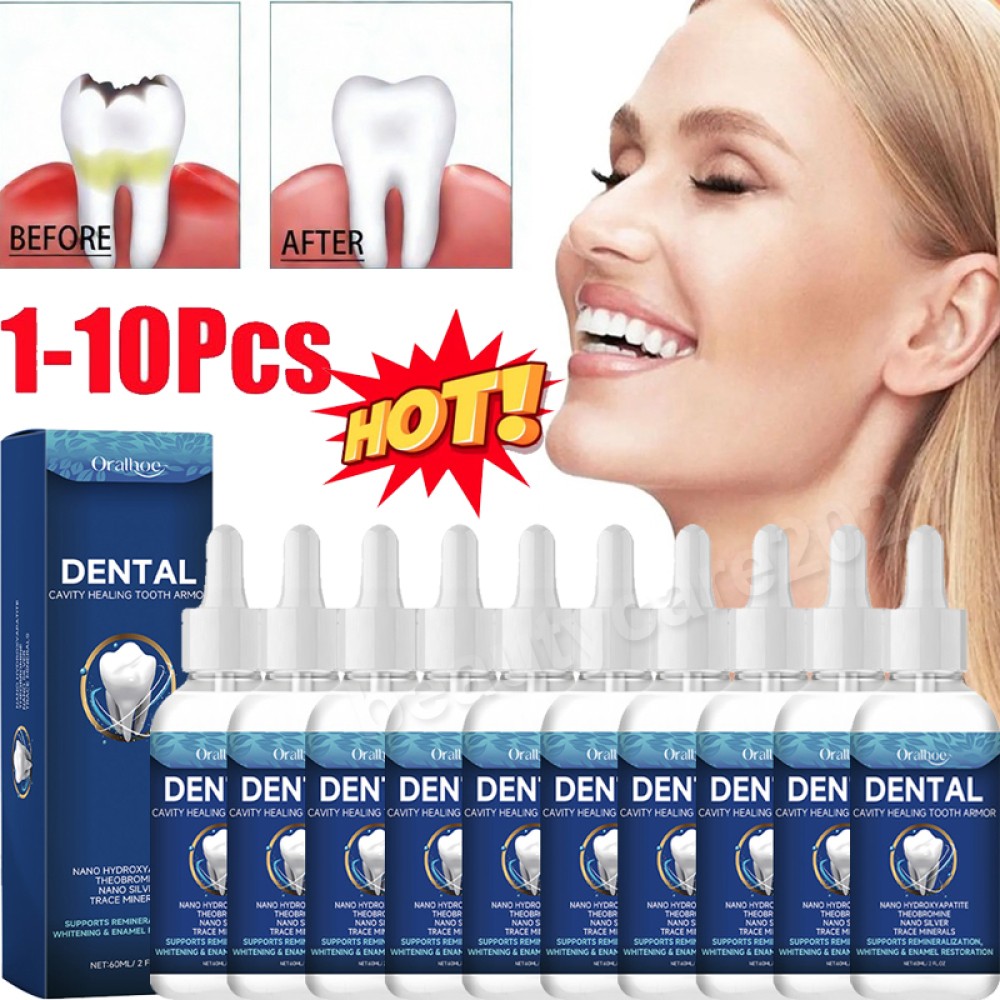 1-10PCS Oralhoe Tooth Care Solution Dental Cavity Healing Tooth Armor Gum Repair