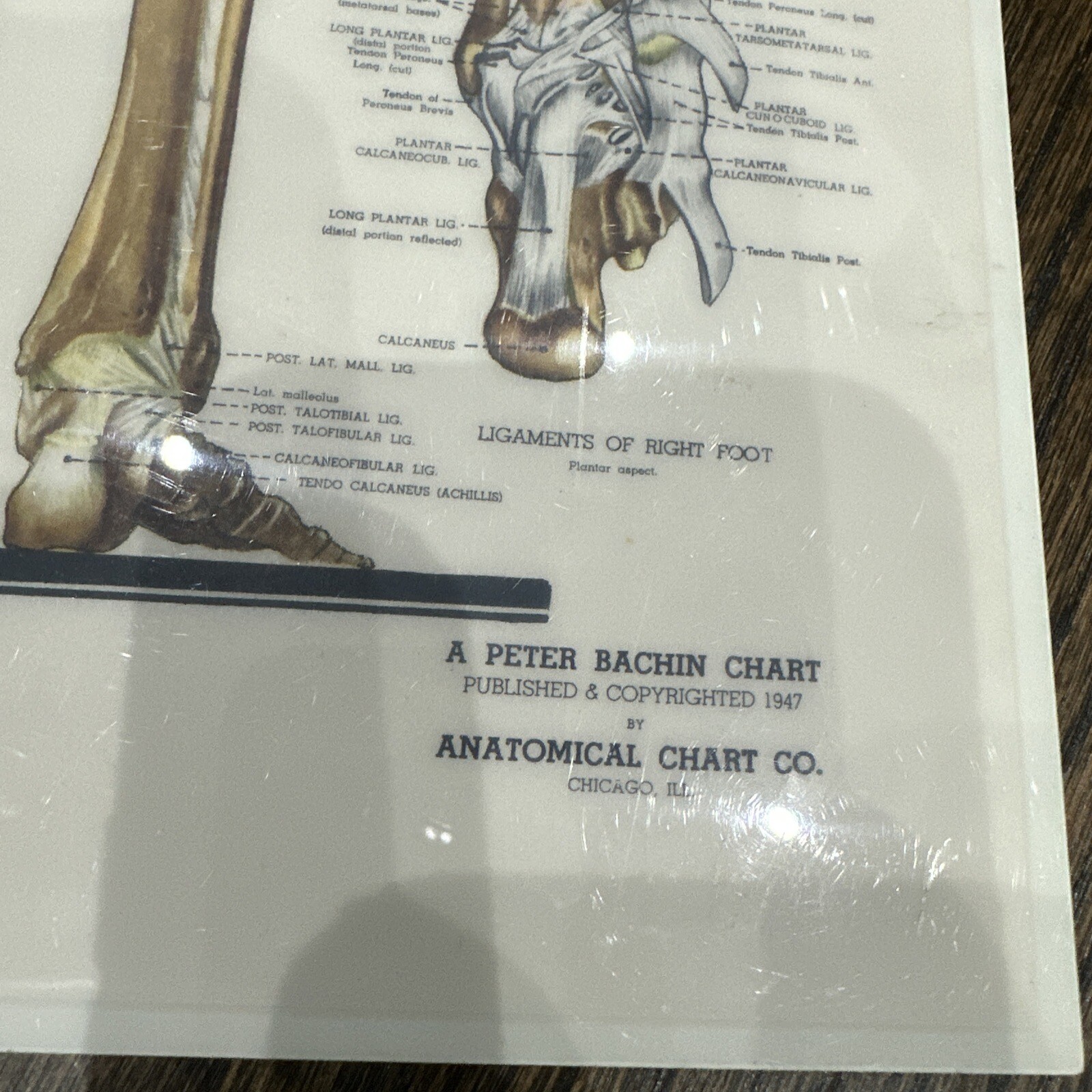 The Skeletal System Peter Bachin 1947 Original Vintage