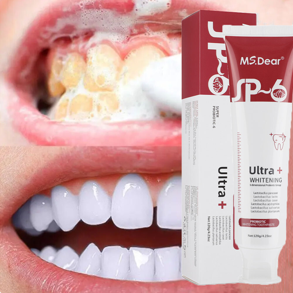 Sp-6 Probiotic Brightening Toothpaste, Deep Cleaning Care Whitening Toothpaste
