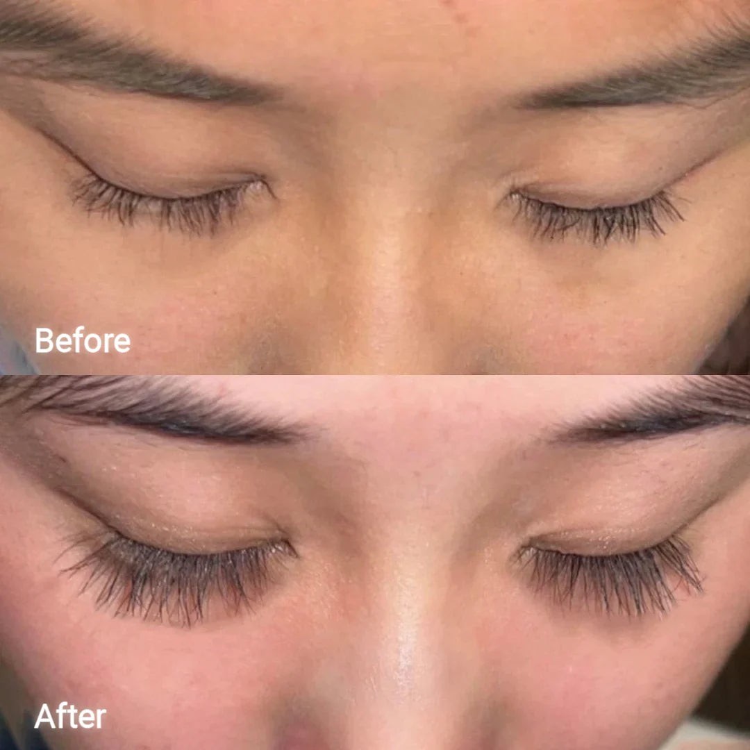 Eyelash Growth Serum Natural – Longer Thicker Lashes Fast – Lash Enhancer