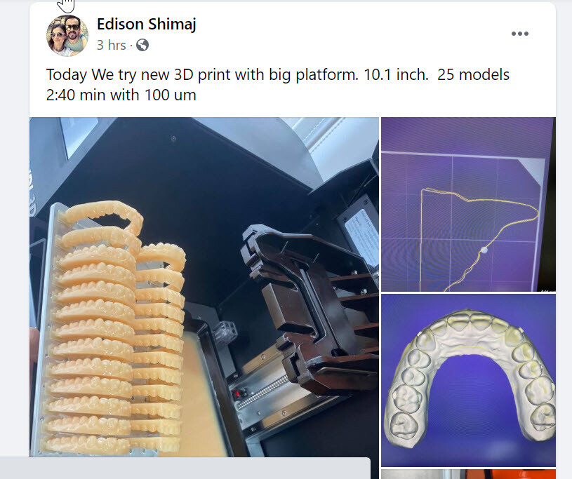 DLP SLA LCD 3d printer high quality resin for dental models