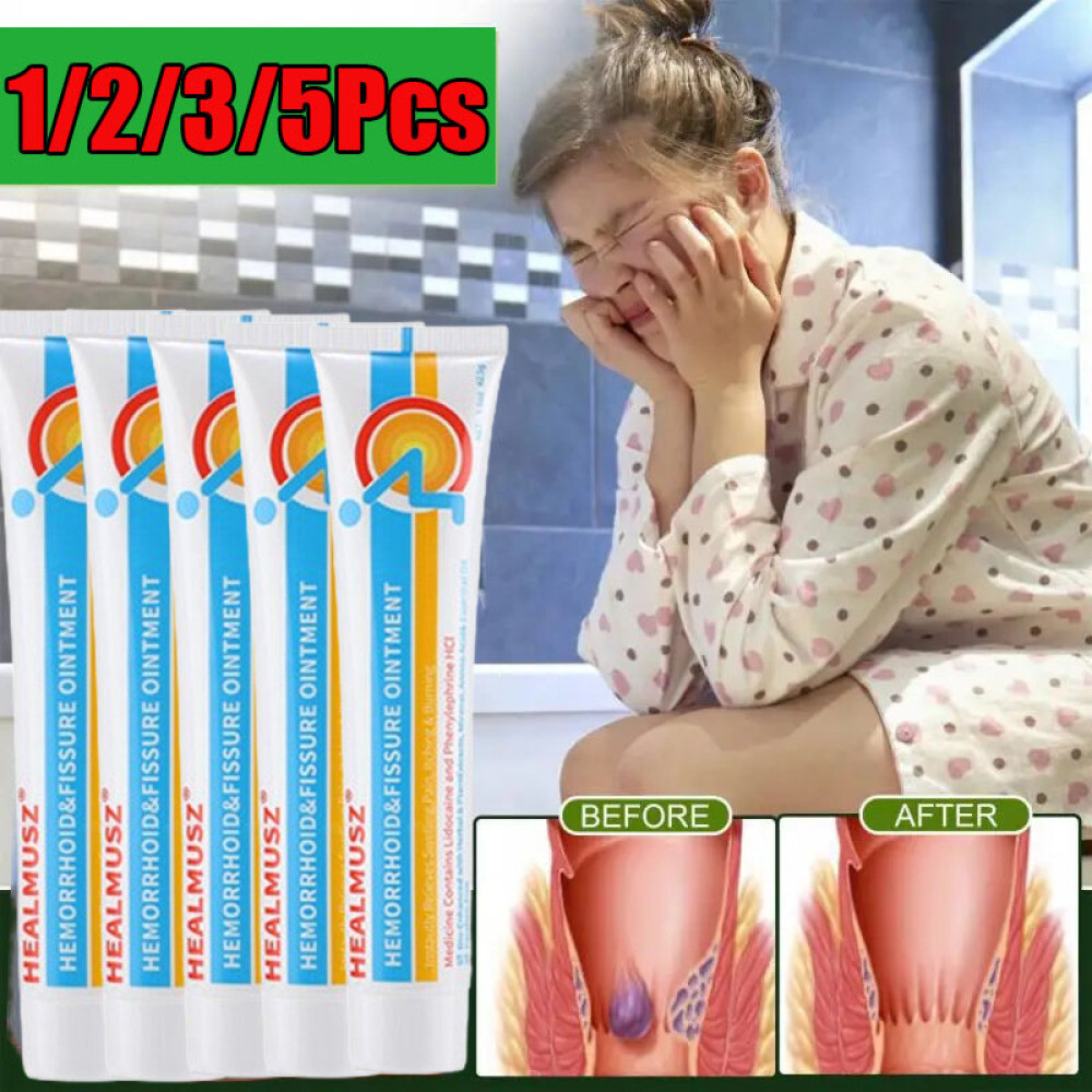5/3 Hemorrhoid Treatment Cream Hemorrhoids Pile Analysis Fissures Shedding Cream