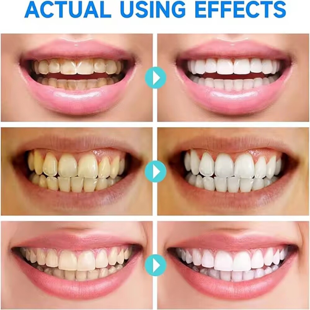 2PCS SP-6 Probiotic Toothpaste,Sp-6 Toothpaste Whitening Quick White Toothpaste