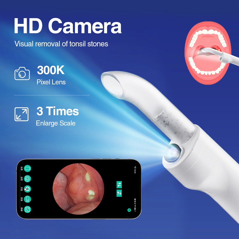 Visible Tonsil Stone Remover Kit with HD Camera, 3 Suction Levels, LED Light