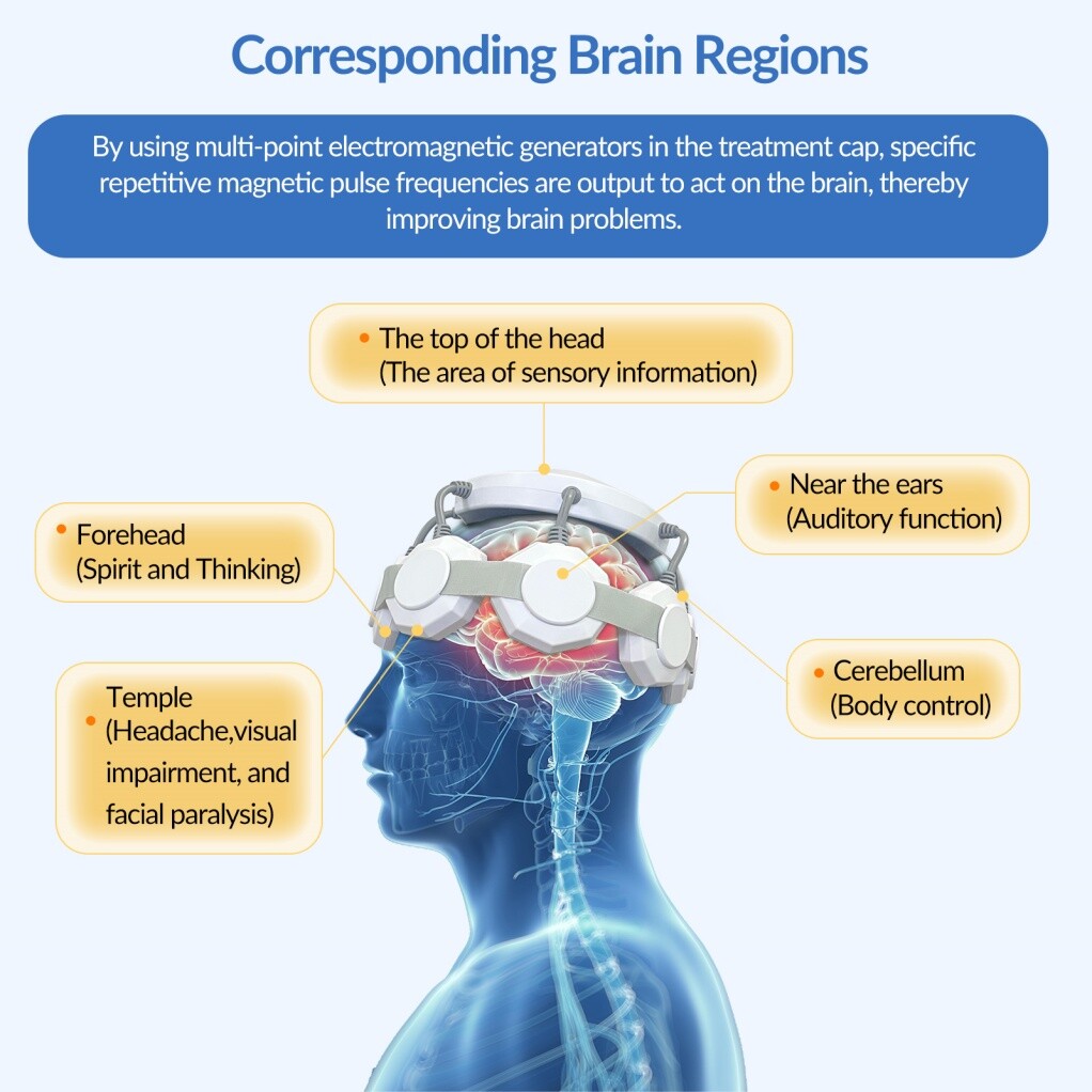 RTMS Transcranial Magnetic Stimulation for Home Medical Use for insomnia stroke