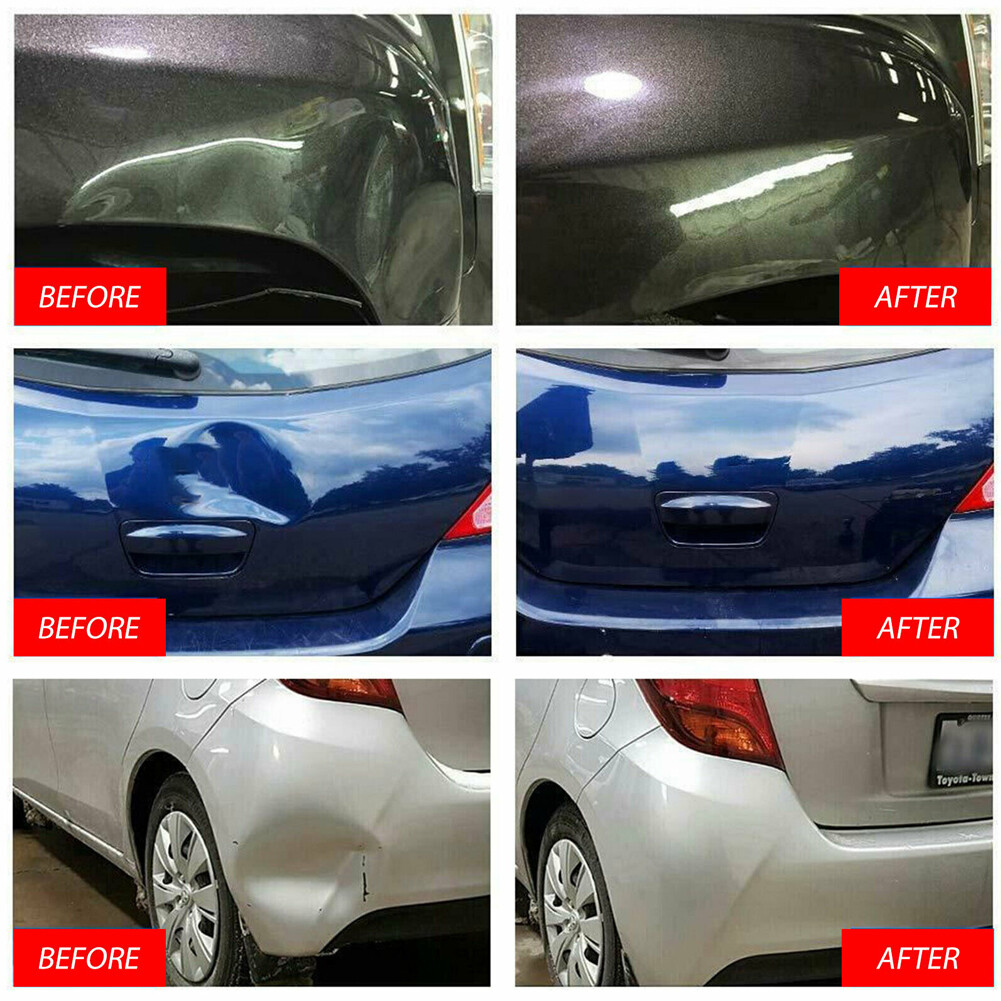 Double Pole Dent Puller Kit - Paintless Hail & Ding Remover for Auto Repair