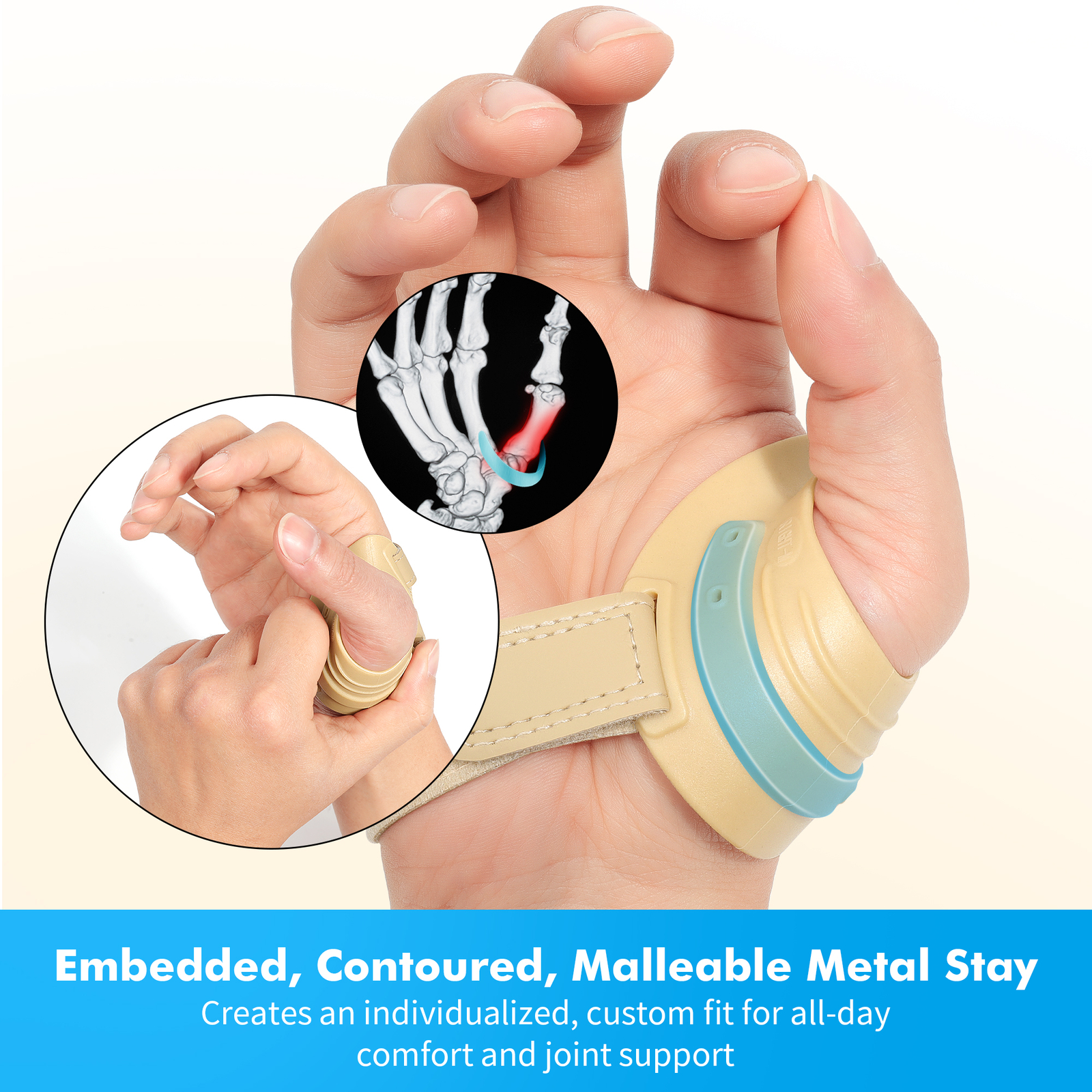 Fortemotus Thumb Brace for Osteoarthritis Splint CMC Joint Arthritis Pain