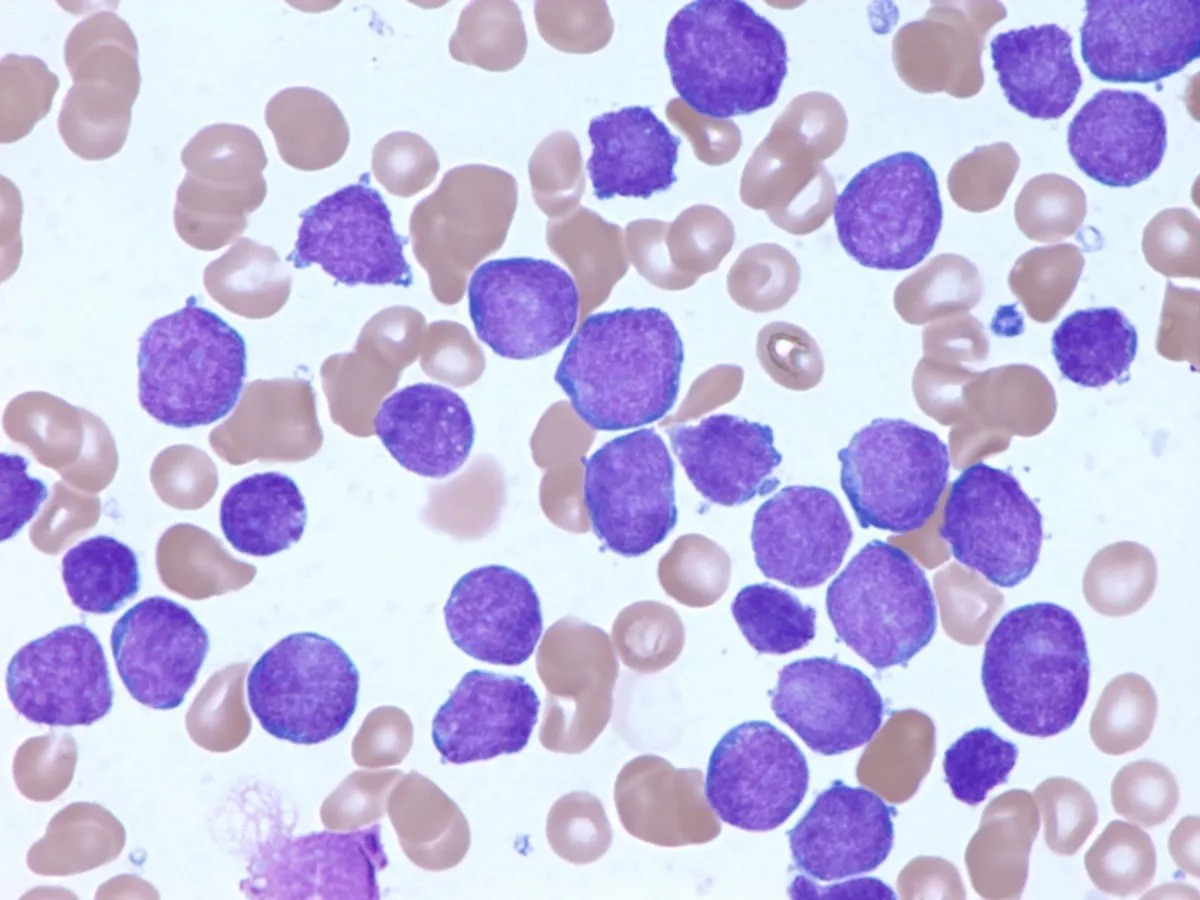 ABGIL Human Pathological preparation (Microscopic Sides)