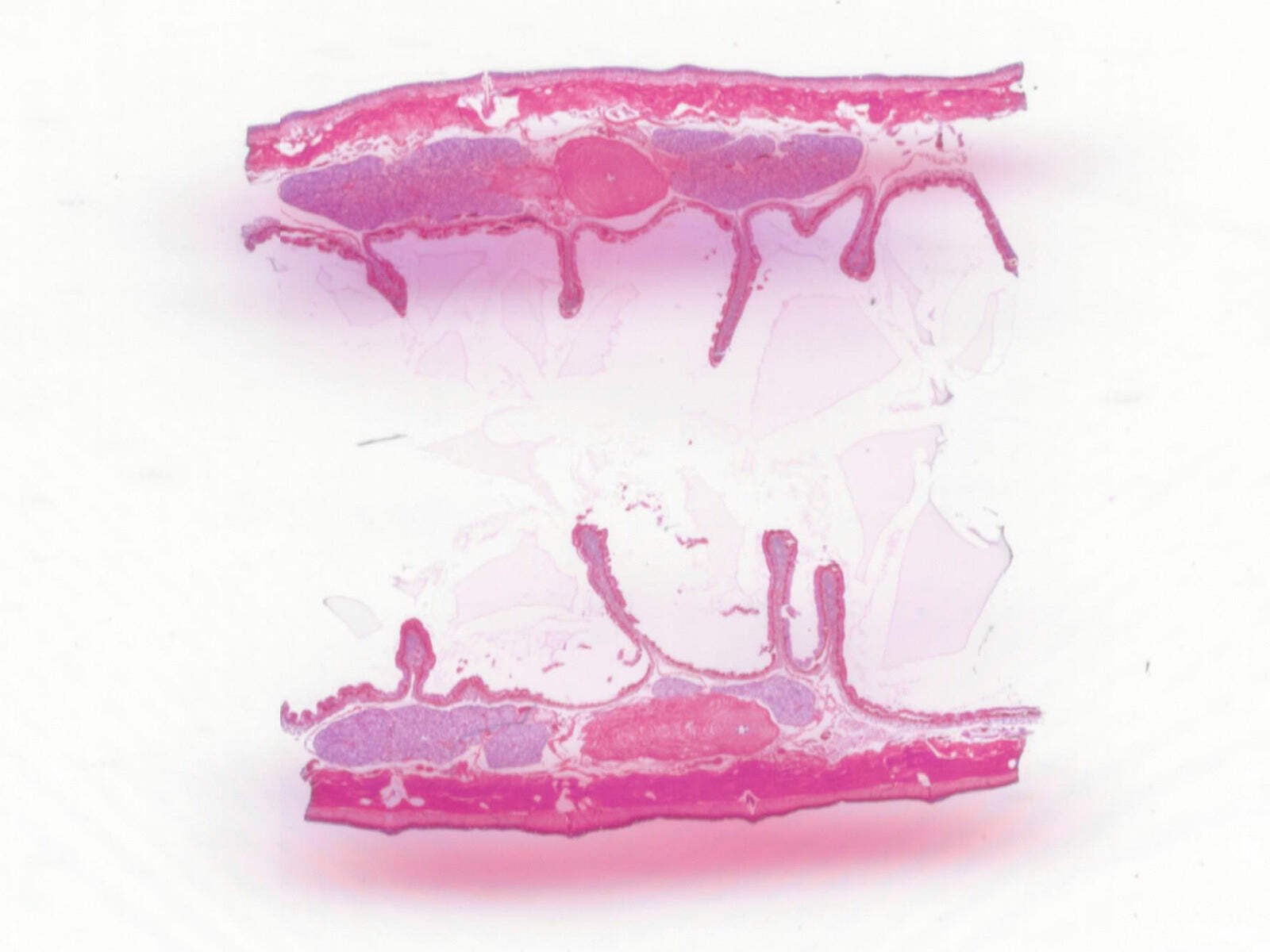 Earthworm (Anellids), 9th-16th Segments, Showing Sex Organs; Longitudinal