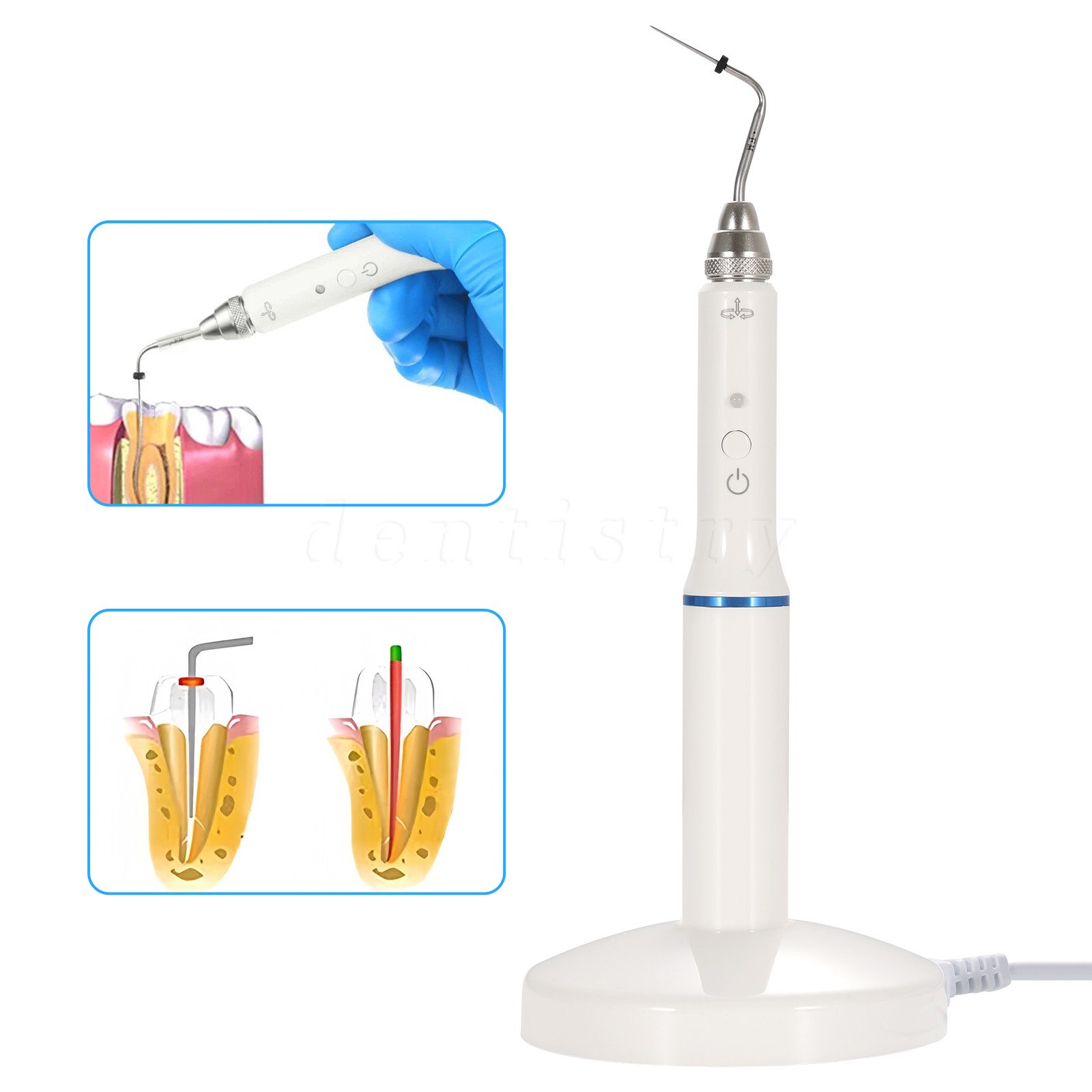Dental Cordless Gutta Percha Obturation System Heated Pen