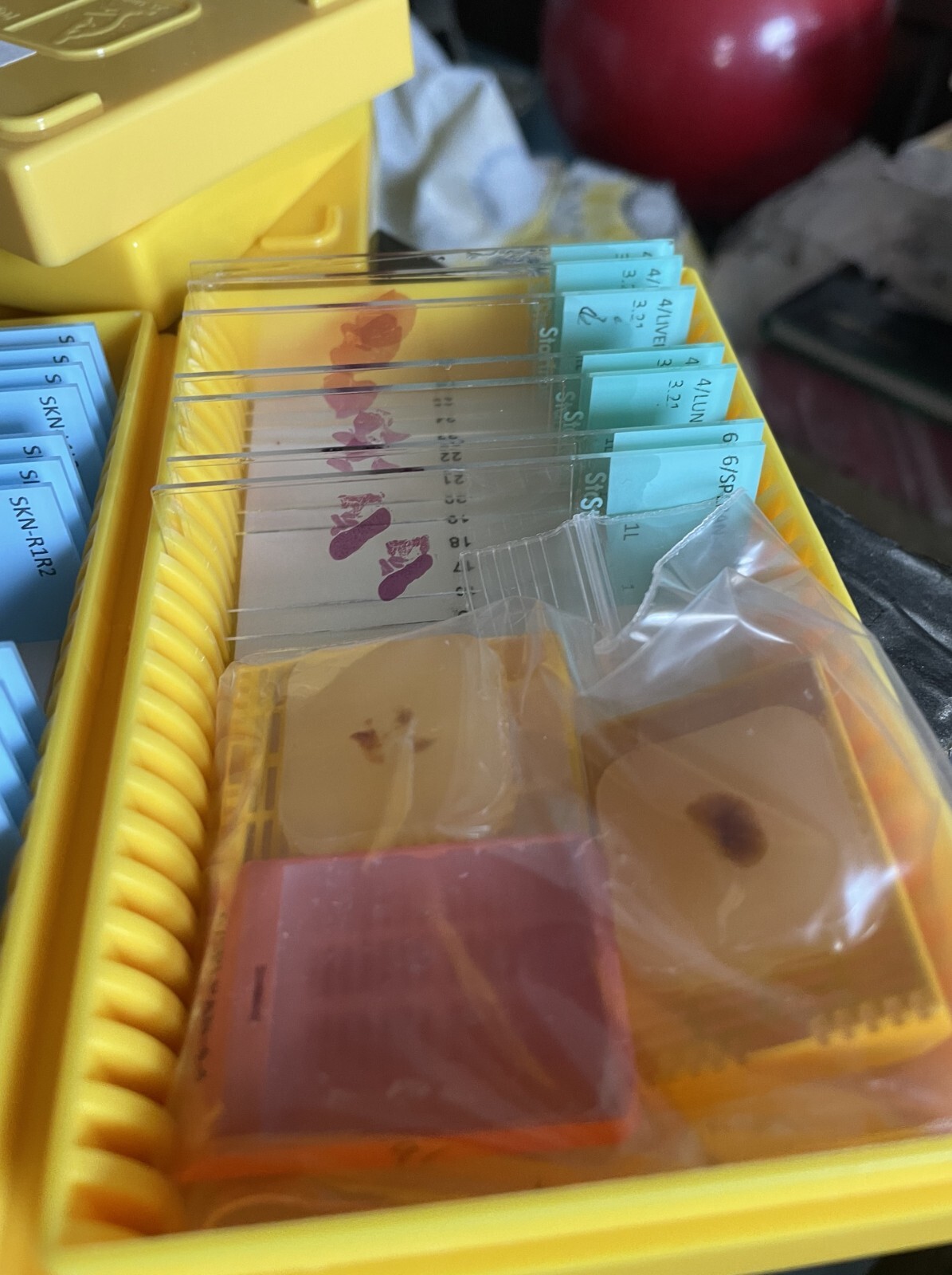 Microscope storage boxes with mouse tissues slides