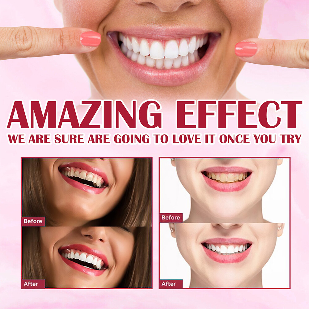 Sp-6 Probiotics Whitening Toothpaste Brightening & Breath Removing Toothpaste US