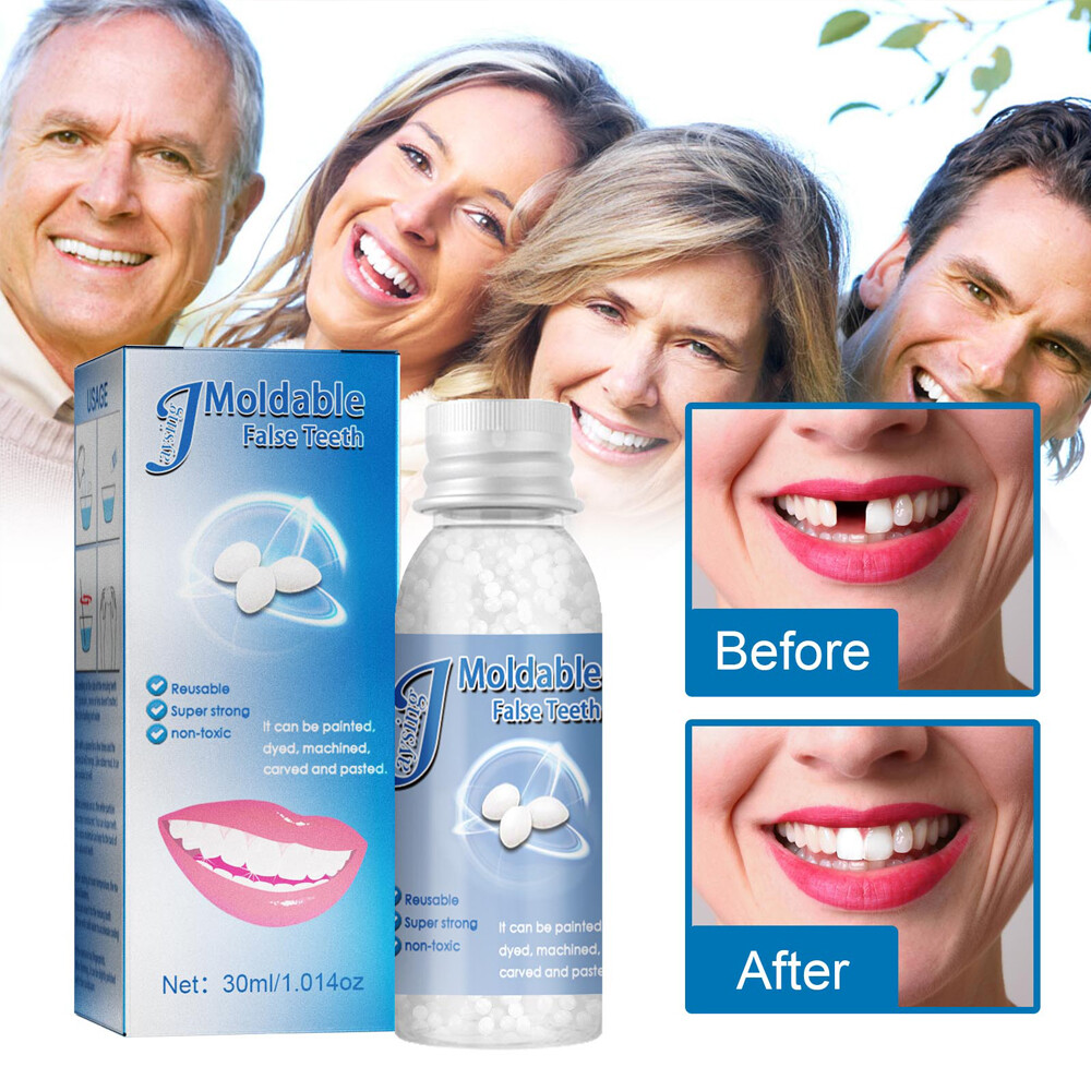 Temporary Tooth Repair Kit Temp Dental Repair Granules Replace Missing DIY Make