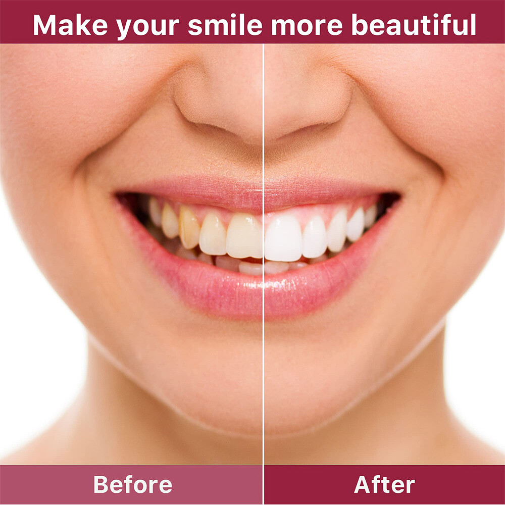 Sp-6 Probiotics Whitening Toothpaste Brightening & Breath Removing Toothpaste US