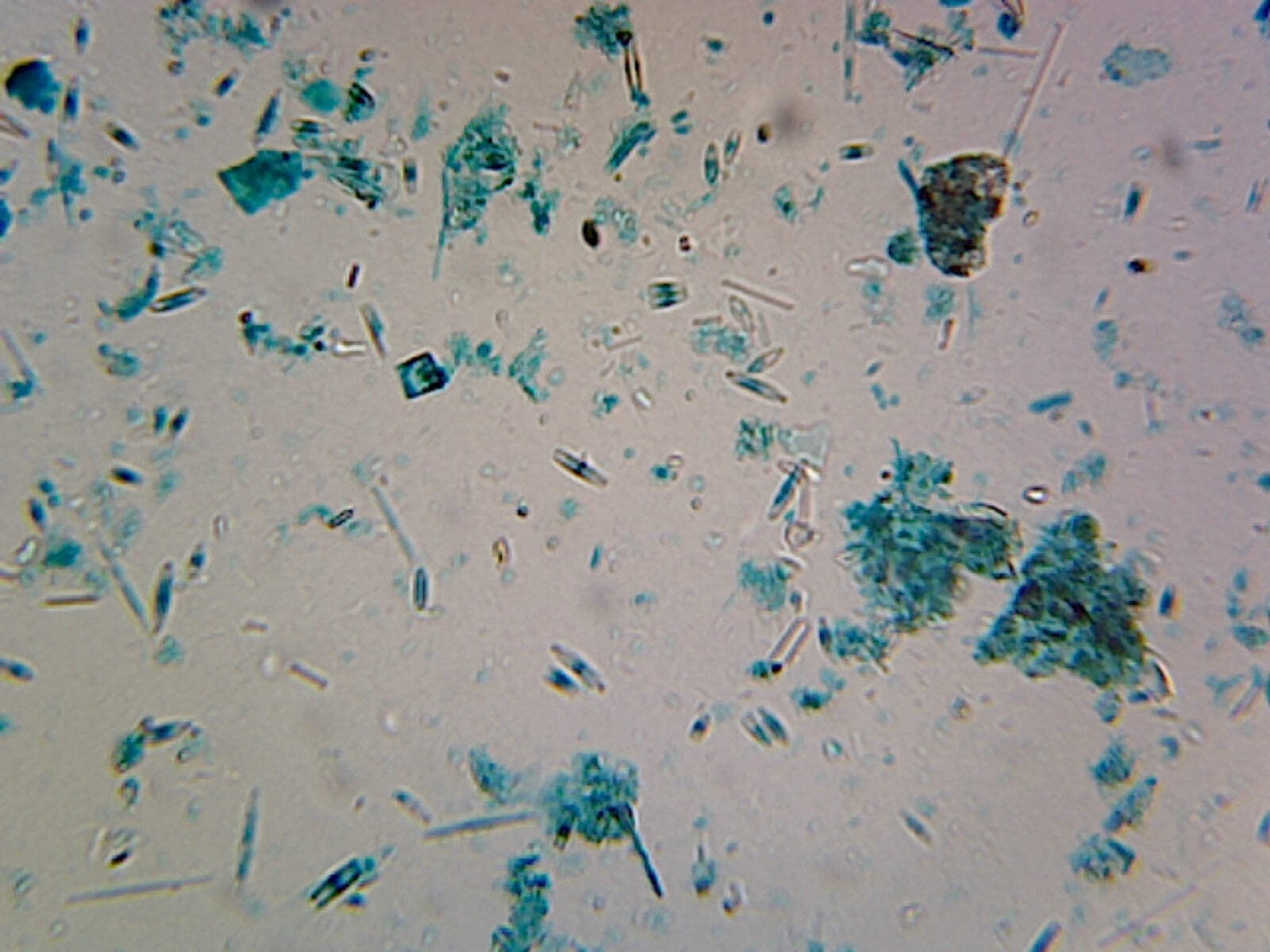 Diatomeae (Comparing Various Mixed Diatoms); Whole-mount