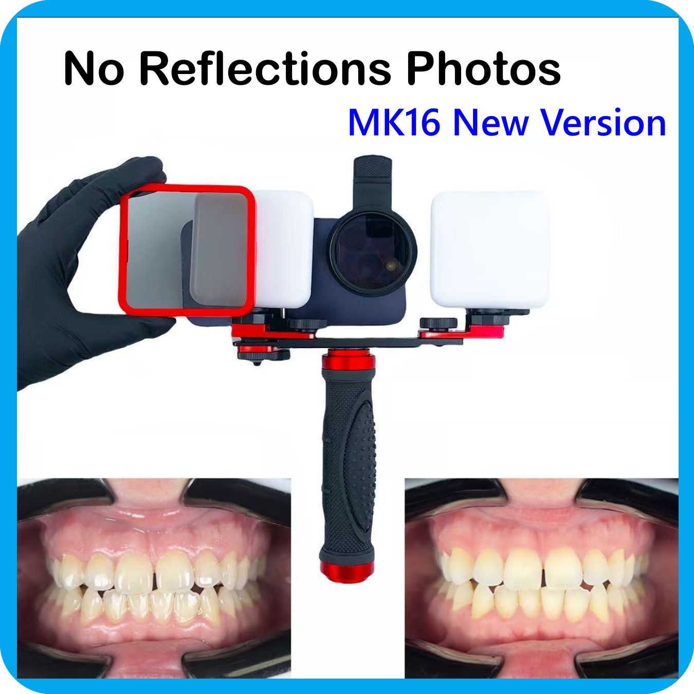 Dentist Photo Light with Brightness Adjustment no-reflective shoot New Version