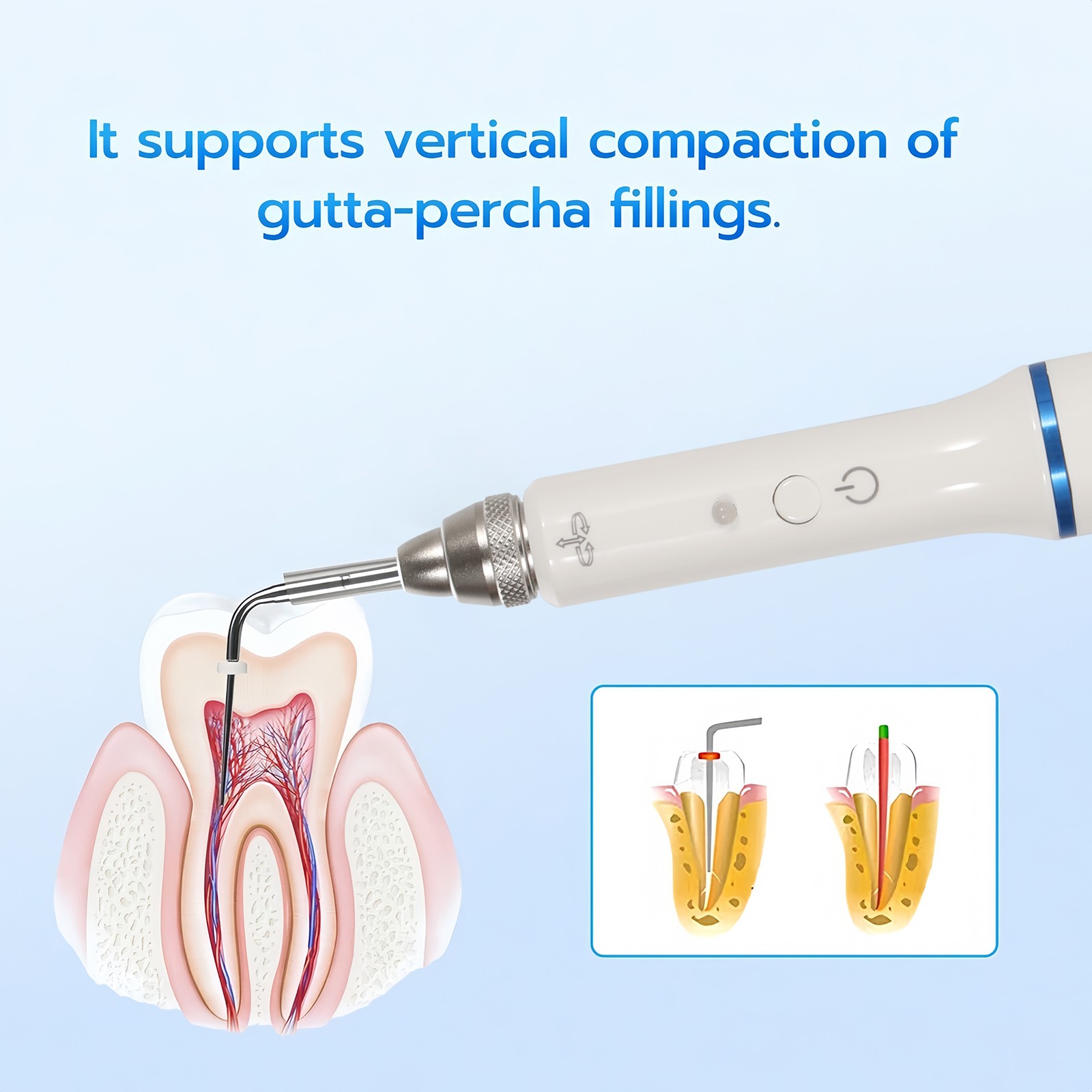 Dental Endodontics Heated Pen Endo Gutta Percha Obturation System 2 Heating Tips