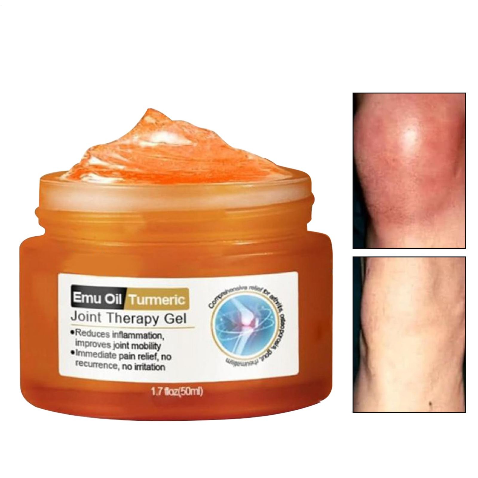Joints Gel Natural Plant Joints Repair Gel Plant Soothing Body Cream Improved