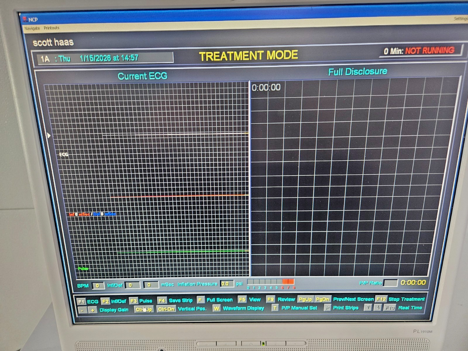 Applied Cardiac Systems NCP-2 EECP Console W/ Patient Cables