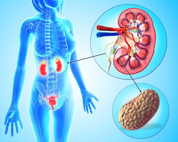 Kidney Flush - KIDNEY SUPPORT - Bladder Health - Kidney Boost - 2 B 120 Ct