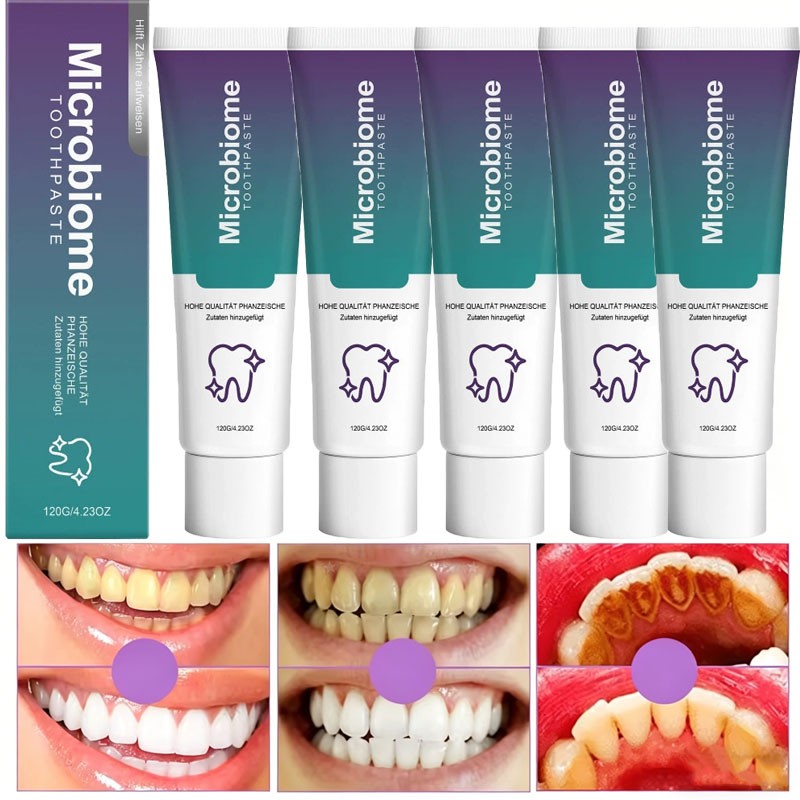 5PCS Microbiome Mint Flavor Gum Toothpaste Cleaning Toothpaste Sensitive Teeth