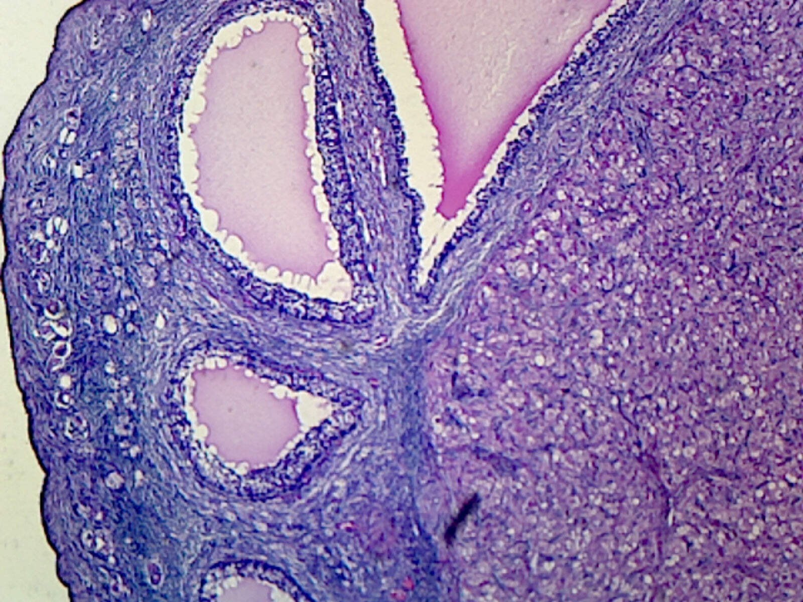 Corpus Luteum, Mammalian; Section