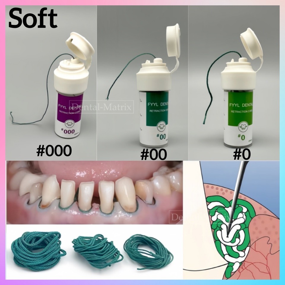 Dental 200cm Gingival Retraction Cord Plain Knitted Cotton Cord #000 #00 #0 Soft