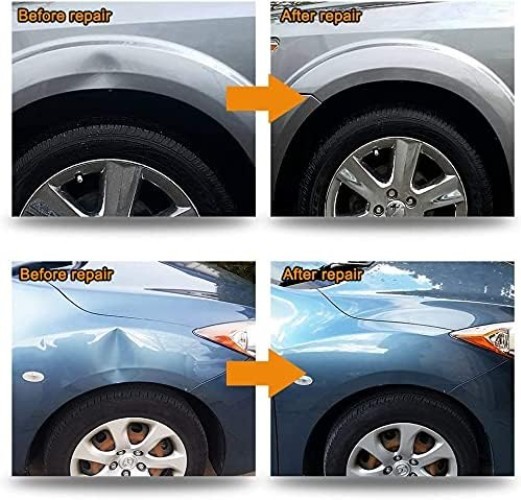 Compact Dent Puller Set with Bridge System for Cars & Appliances - 1.87 lbs