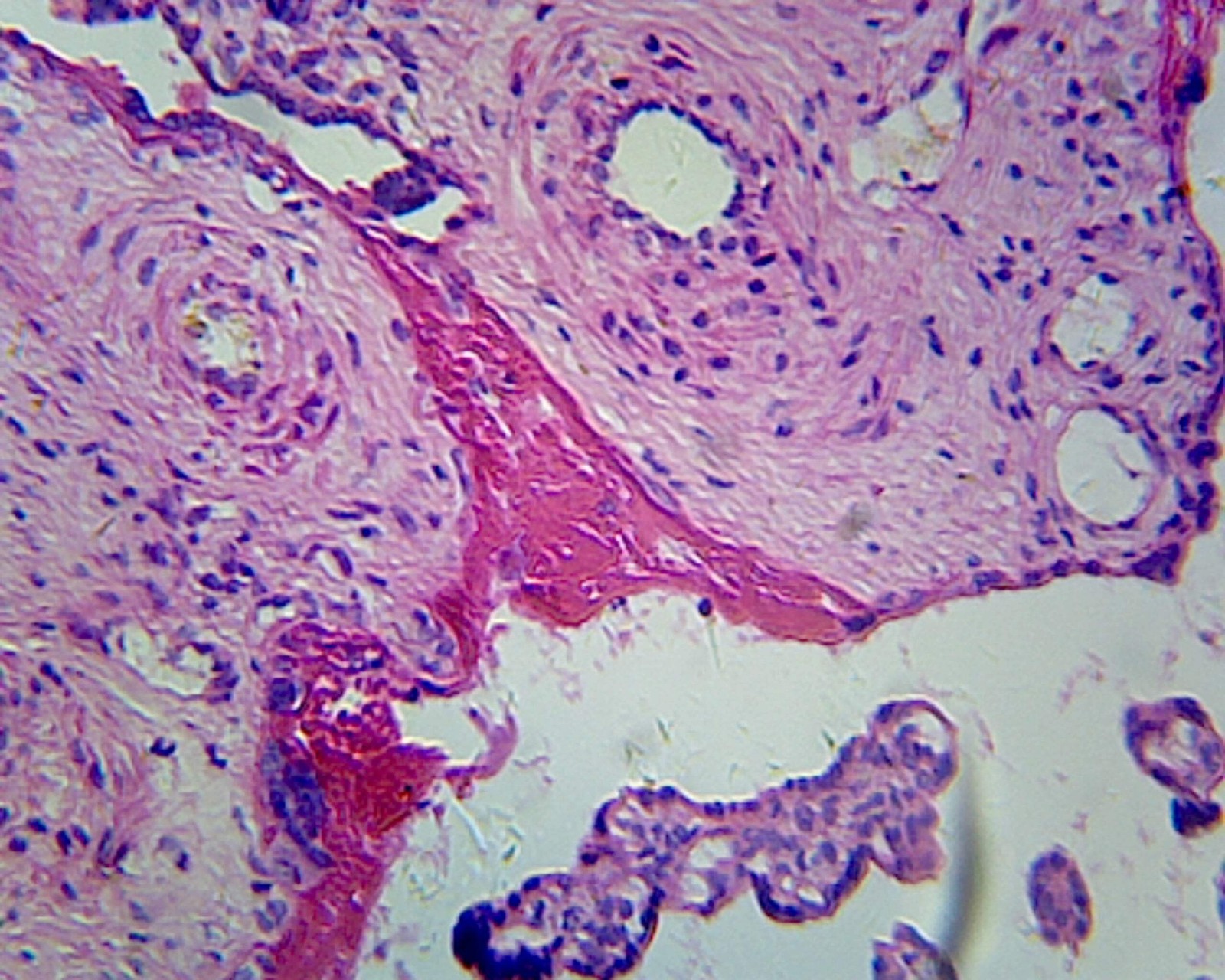 Placenta, Human; Showing Chorionic Villi; Section