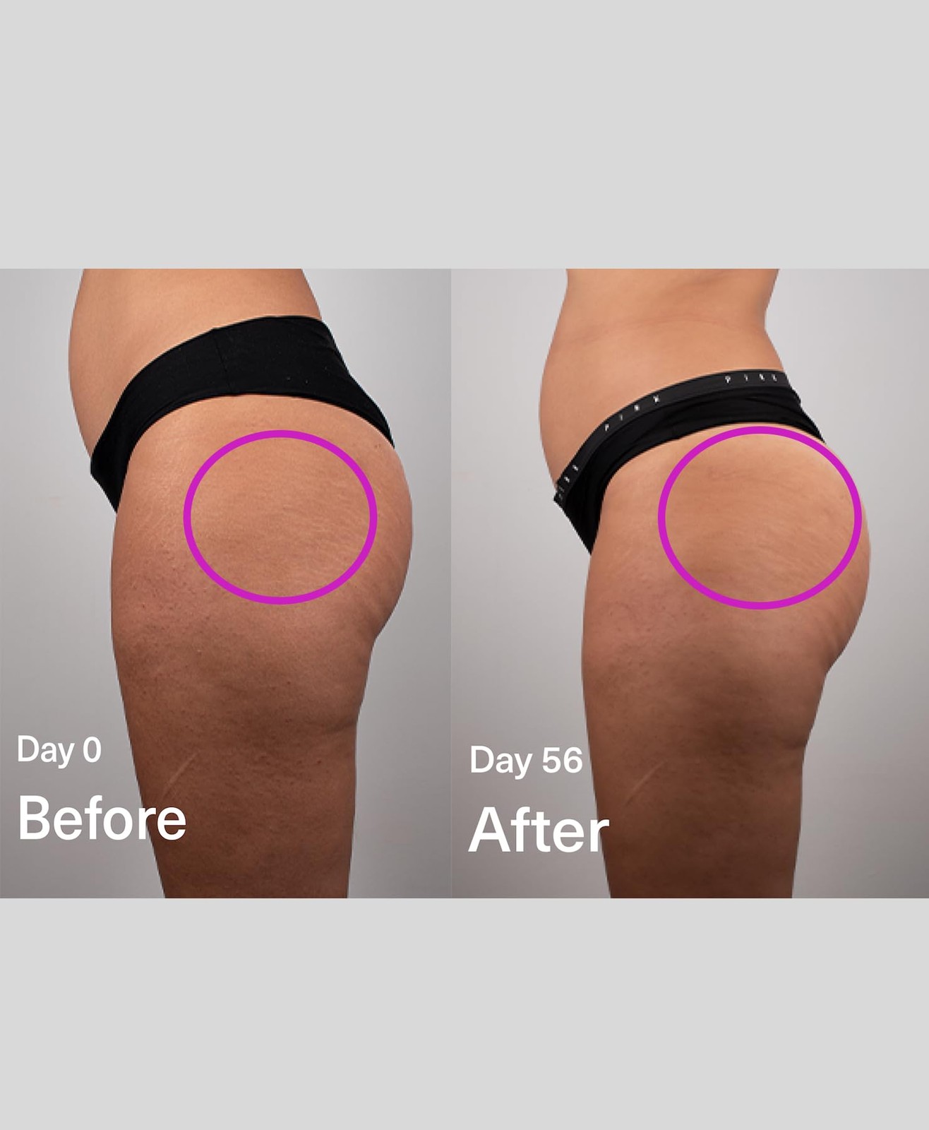 SickScience DropOff Advanced Exosome Body Firming & Sculpting Cream | Targets St