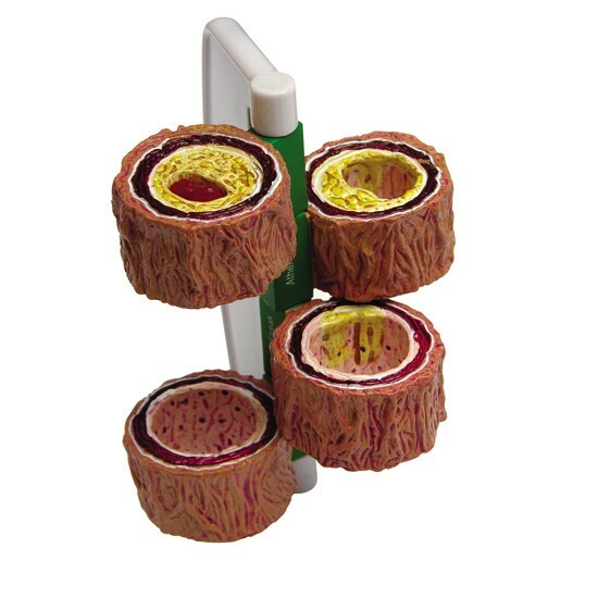 Artery 4-piece Anatomical Model   GPI  LFA #2650 SEE VIDEO Make Us an Offer!